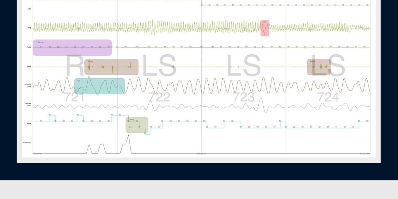 EnsoData’s Celeste+ App Adds 3 Channels to Home Sleep Testing Solution