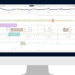 EnsoData’s Celeste+ App Adds 3 Channels to Home Sleep Testing Solution