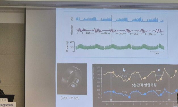 Tracking Blood Pressure During Sleep—Without a Cuff