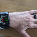 What Blood Pressure Monitoring Misses in Sleep Patients