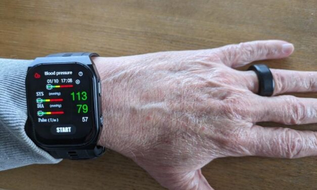 CirculVS Watch Ring
