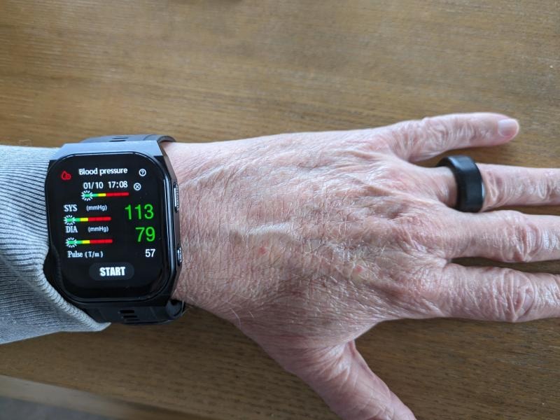What Blood Pressure Monitoring Misses in Sleep Patients