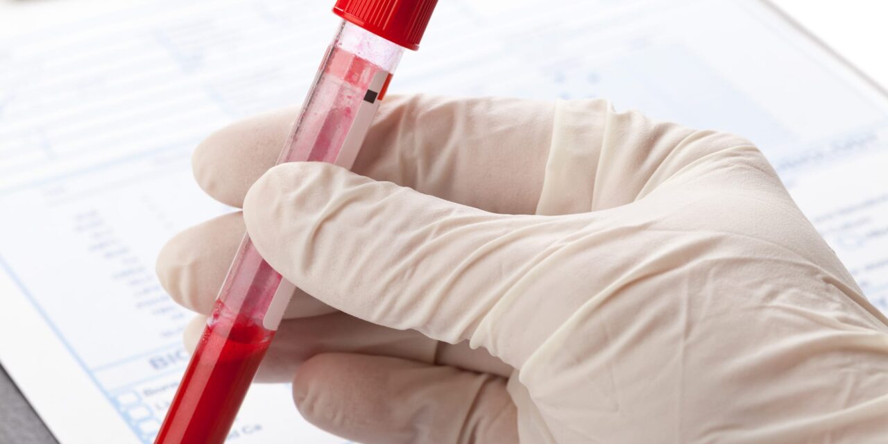 Blood Test May Predict Dementia Years Before Onset in REM Sleep Behavior Disorder