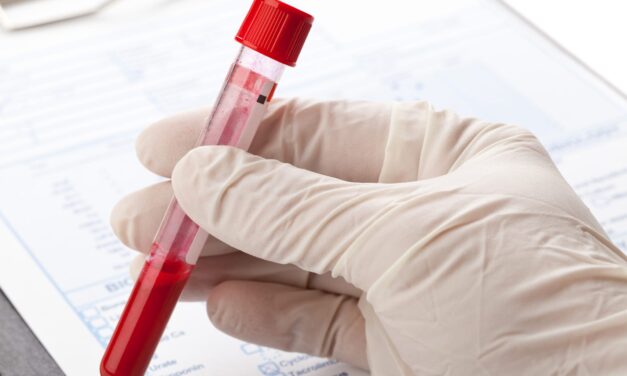 Blood Test May Predict Dementia Years Before Onset in REM Sleep Behavior Disorder