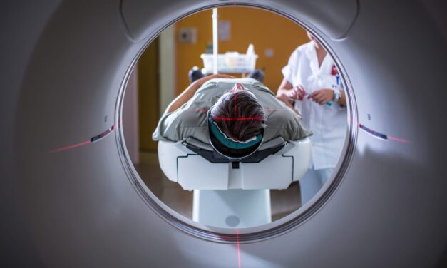 REM Sleep Behavior Disorder Brain Scans Reveal Two Distinct Paths to Neurodegeneration
