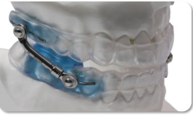 Vivos’ Budget Oral Appliance Earns PDAC Verification