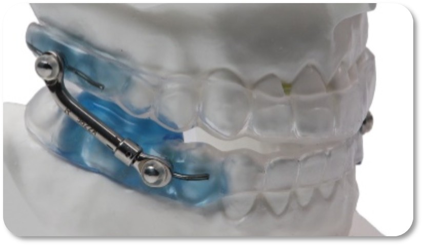 Vivos’ Budget Oral Appliance Earns PDAC Verification