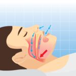 Pivotal Phase 3 Topline Results for Neuromuscular-Targeting OSA Drug Candidate