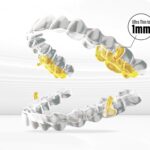 Shanghai Company Develops Aligner That Treats Sleep Apnea and Straightens Teeth