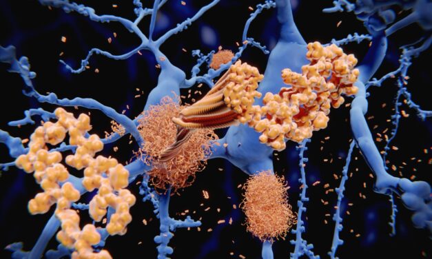 Sleep Is a Powerful Defense Against Alzheimer’s Disease