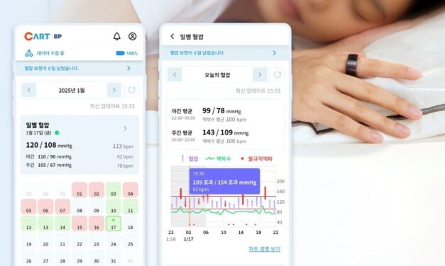 Sky Labs Launches Ring for 24-Hour Blood Pressure Tracking