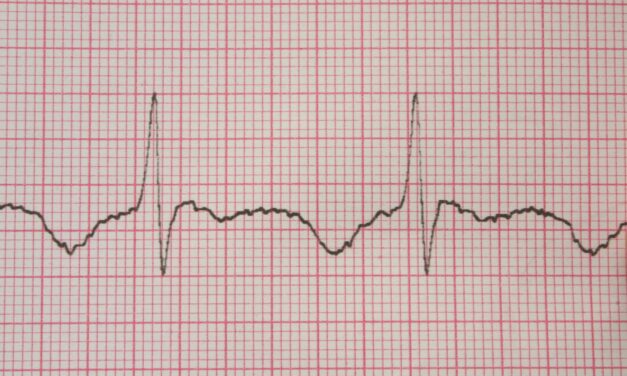 AI Algorithm Uses ECG to Identify OSA, Finds Stronger Signal in Women