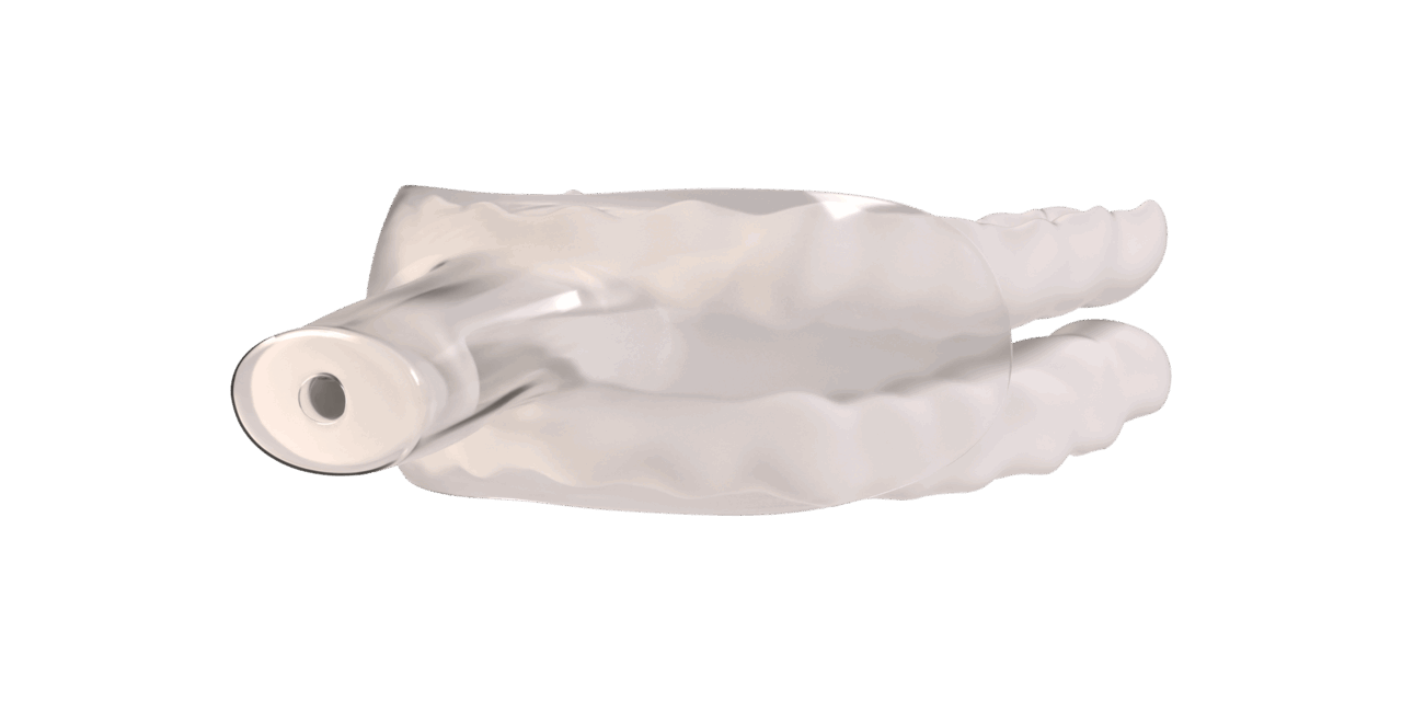 Nylon FlexTAP Gains Medicare Coverage