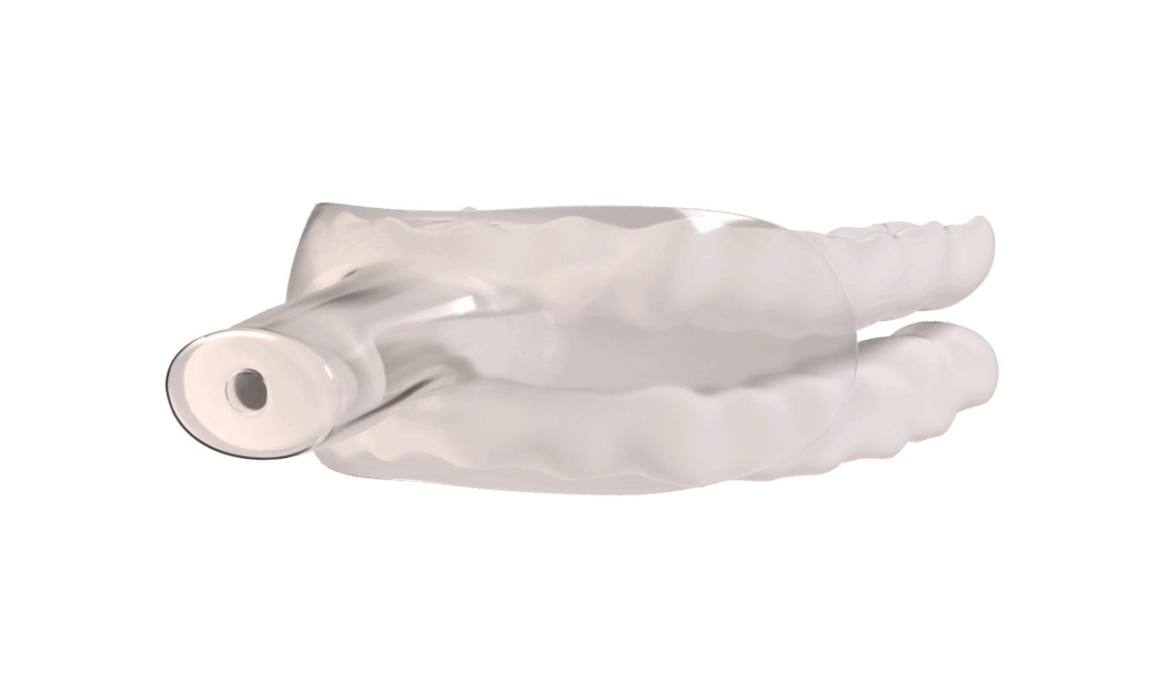 Nylon FlexTAP Gains Medicare Coverage