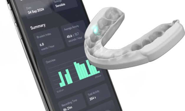 Biofeedback Device Reduces Sleep Bruxism by 60% in Clinical Study