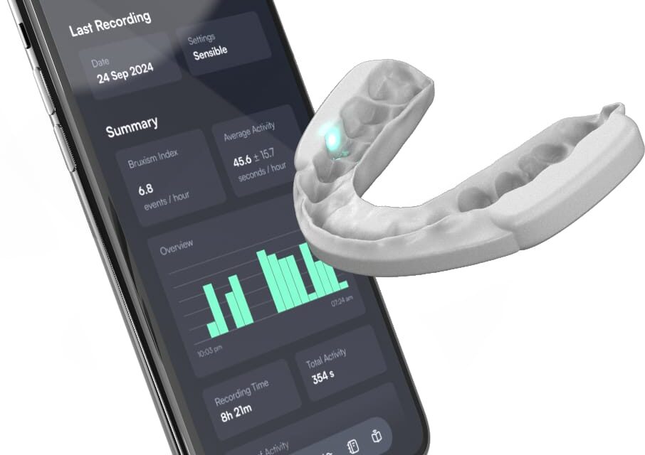 Biofeedback Device Reduces Sleep Bruxism by 60% in Clinical Study