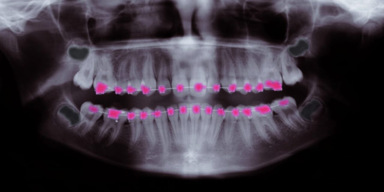 Orthodontics name airway