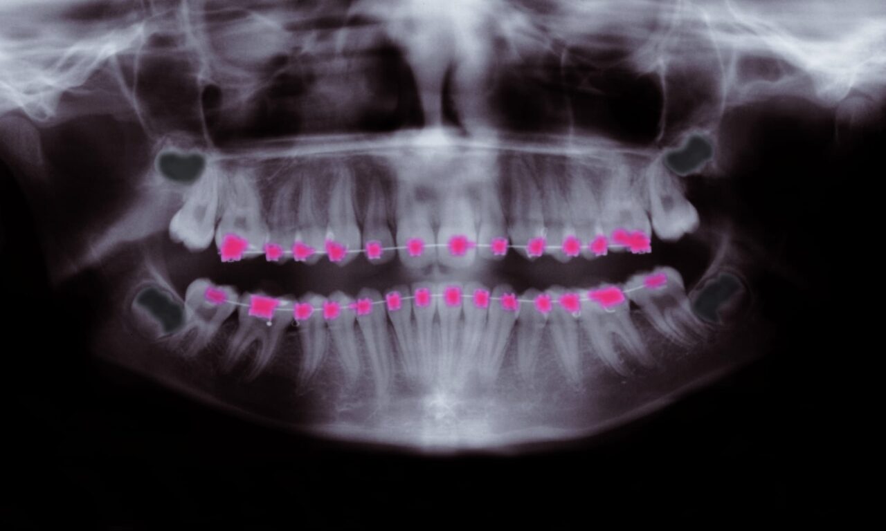 What Should ‘Orthodontics’ Be Called, Anyway?