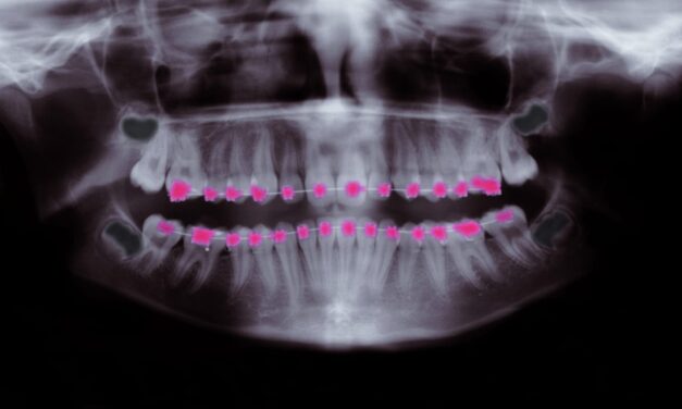 What Should ‘Orthodontics’ Be Called, Anyway?