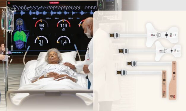 Masimo SET Pulse Oximetry Accurate Across Skin Tones in ICU Feasibility Study
