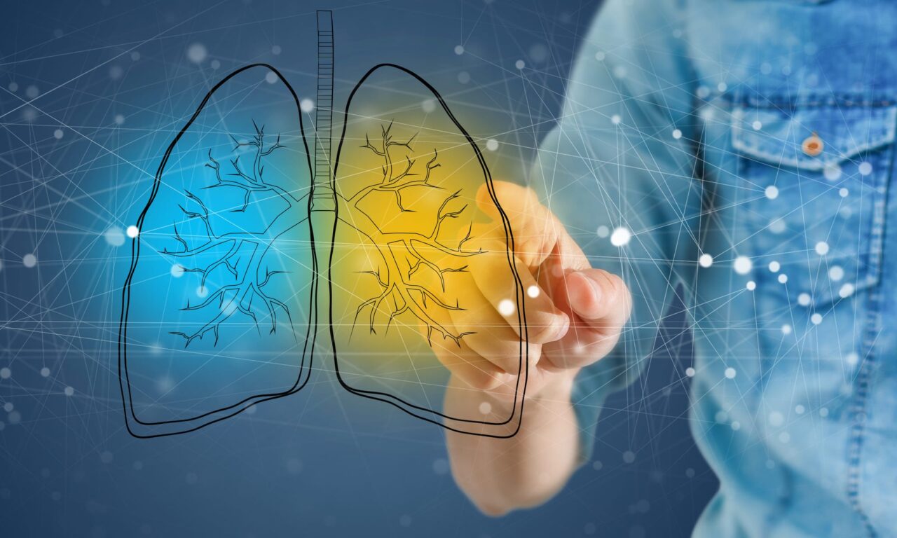 Will The CPAP Algorithm Boom Deliver Real Innovation?