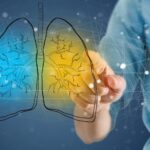 Will The CPAP Algorithm Boom Deliver Real Innovation?
