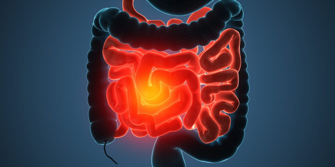 Wearable Data Links Sleep Disruption to IBD Inflammation