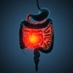 Wearable Data Links Sleep Disruption to IBD Inflammation