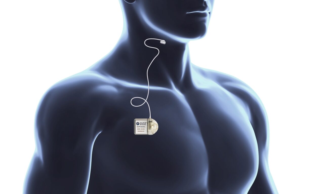 12-Month Results from LivaNova’s OSPREY Clinical Study Published