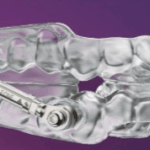 3D Resin-Printed Herbst Oral Appliance Receives Medicare E0486 Approval