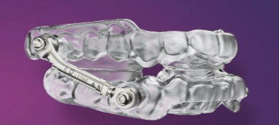 3D Resin-Printed Herbst Oral Appliance Receives Medicare E0486 Approval