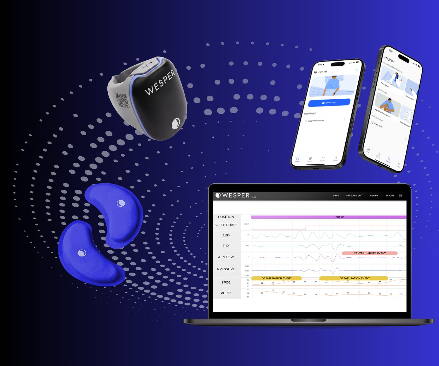 wesper ecosystem