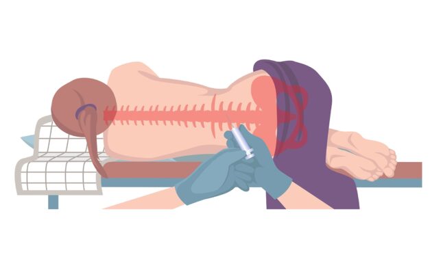 How Orexin-A Testing Could Become Easier 