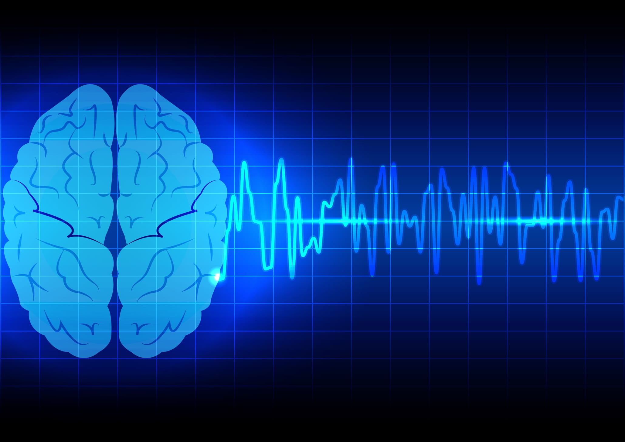 Why Microsleeps May Redefine ‘Quality of Wake’ in Narcolepsy Type 1
